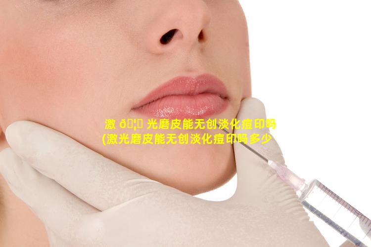 激 🦟 光磨皮能无创淡化痘印吗(激光磨皮能无创淡化痘印吗多少钱)